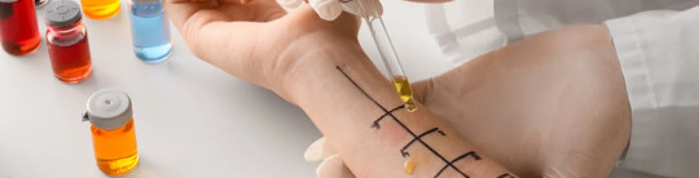 Allergy Testing Banner